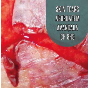 Skin Tears Abordagem Avançada