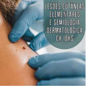 Lesões Cutâneas Elementares e Semiologia Dermatológica